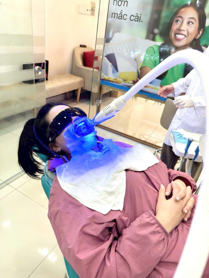 Laser teeth whitening at Chi Chi Dental